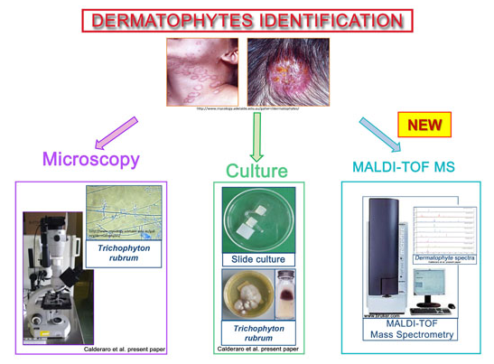 Identification des infections à dermatophytes