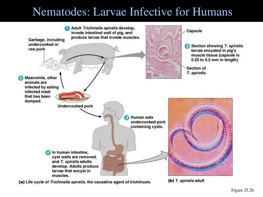 Larves de nématodes infectieuses pour l'homme