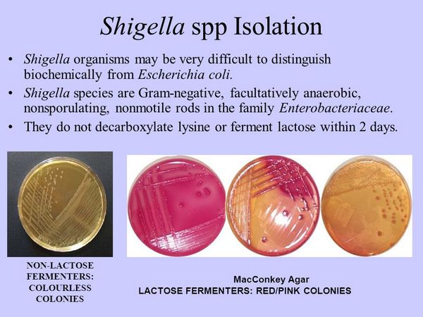 Espèces de Shigella