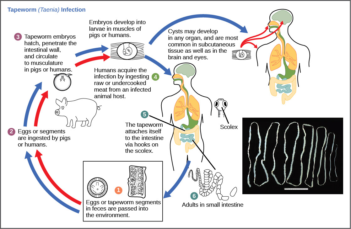 Infection par Taenia saginata