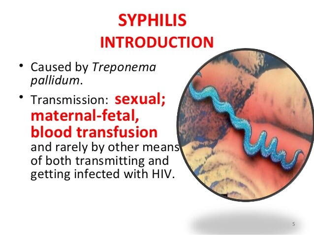 Syphilis Treponema pallidum